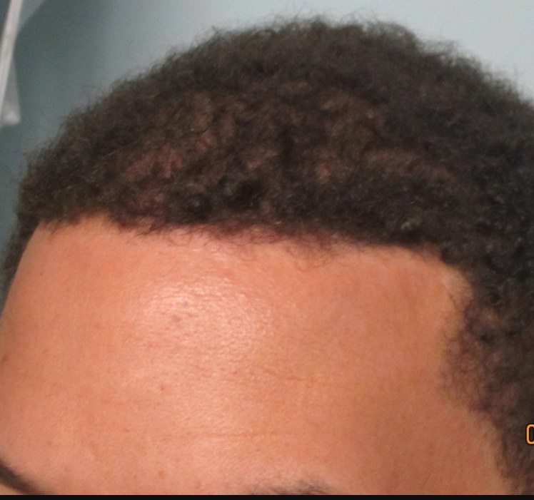 After transformation