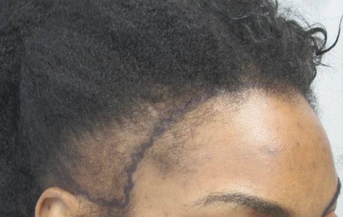 Before transformation